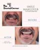 Slider image (9) The Dental Corner